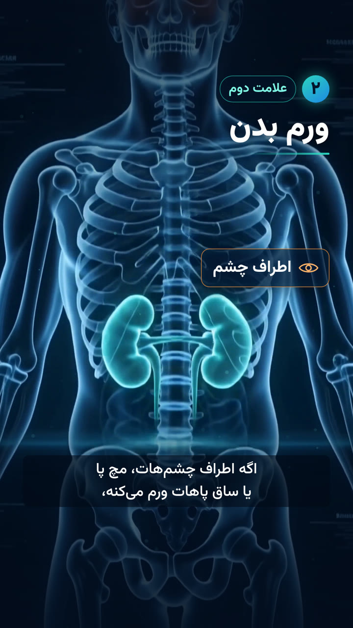 ۳ علامت کلیه — Instagram Reel | made with ngram
